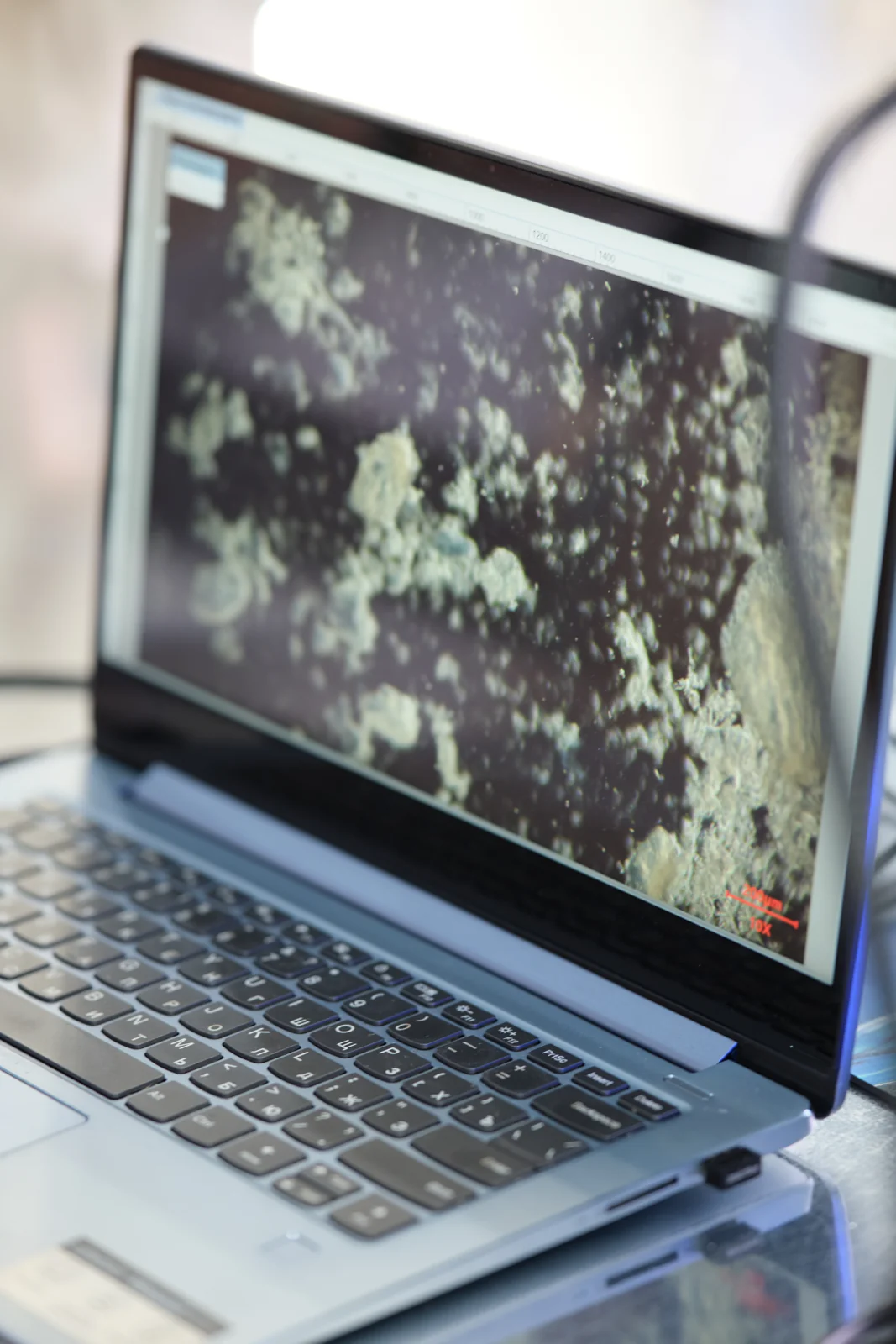 Microscopic imaging results displayed on a laptop